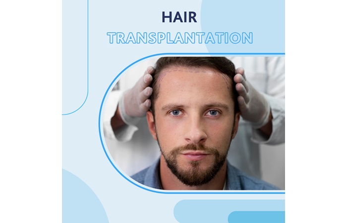 Hair Transplant